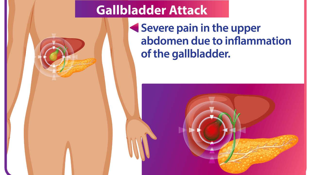 Gallbladder Stone Symptoms